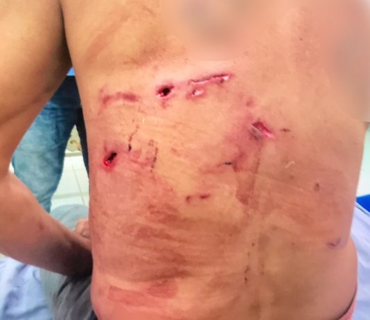 Homem atacado por onça-pintada é salvo por 5 cachorros em MS