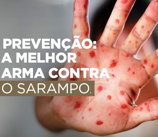 Campanha nacional contra o sarampo começa nesta segunda-feira