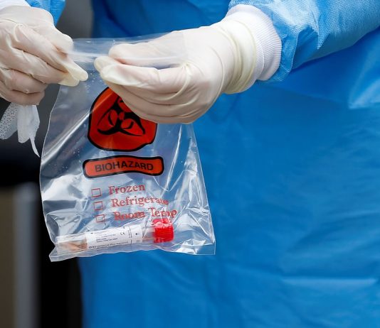 Covid-19: país tem 121,3 mil mortes e 3,9 milhões de casos acumulados