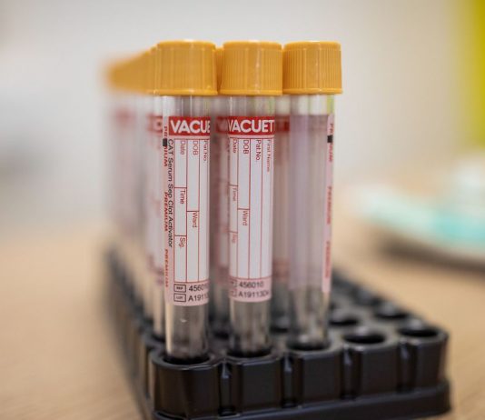 Covid-19: Pfizer e BioNTech pedem uso emergencial de vacina na Europa