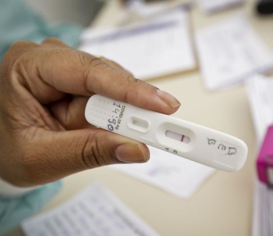 Anvisa aprova uso e comercialização de autoteste para covid-19