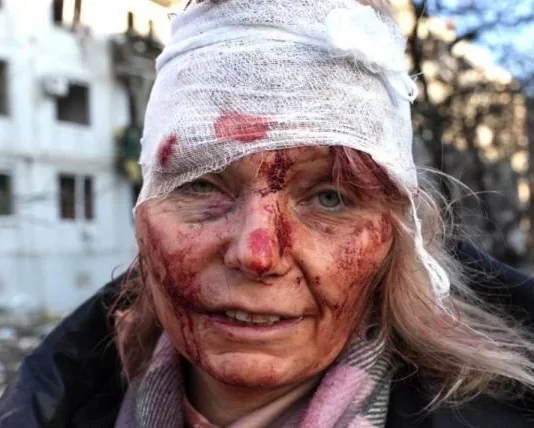 10 imagens do conflito entre Rússia e Ucrânia