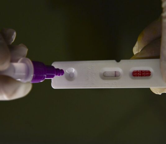 Pesquisadores identificam método capaz de prever gravidade da covid-19