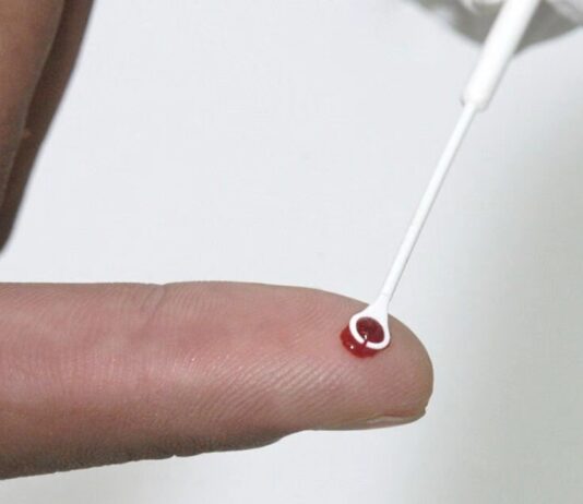 Paciente é declarado curado do HIV após receber células-tronco