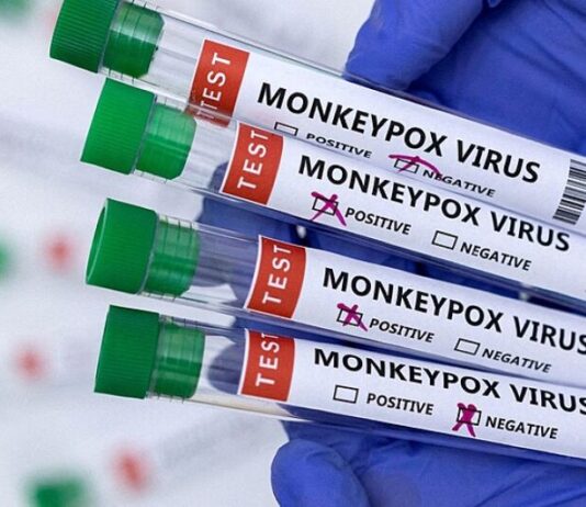 Douradense contaminado com “varíola dos macacos” viajou para o Paraguai recentemente