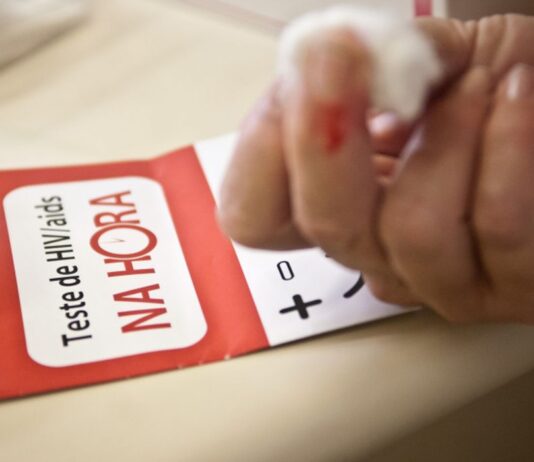 Desigualdades e estigmas prolongam pandemia de Aids