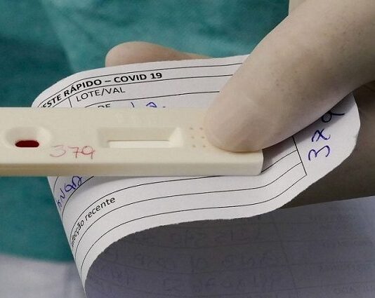 MS tem 273 novos casos de covid na última semana e três mortes registradas