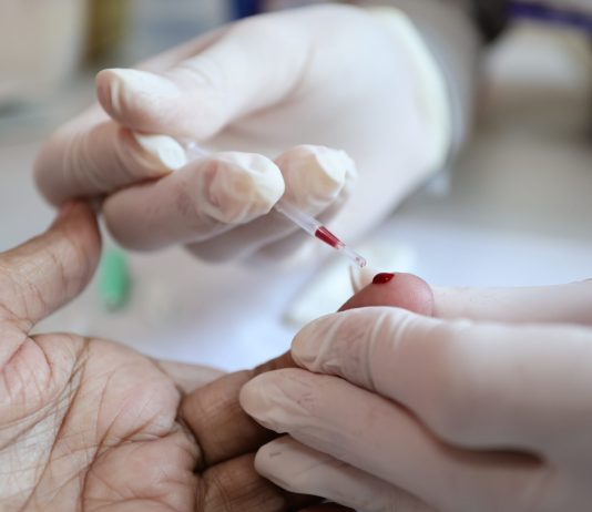 DOURADOS: Prefeitura reforça ações de prevenção e diagnóstico das hepatites virais