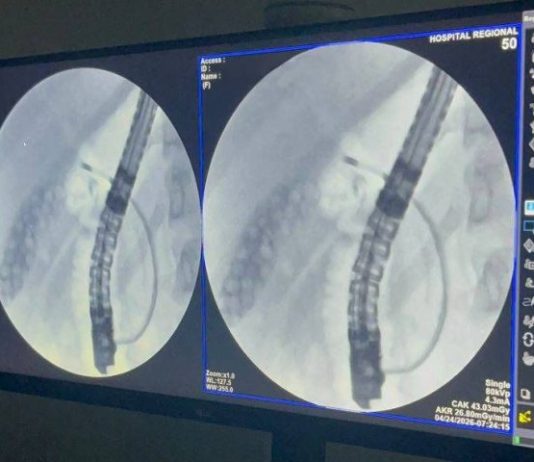 DOURADOS: exame inédito marca avanço da alta complexidade no Hospital Regional