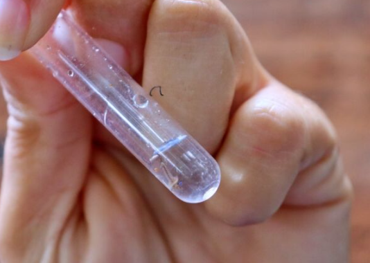 Com mais um caso confirmado, sobe para 14 número de mortes pela Chikungunya em Dourados