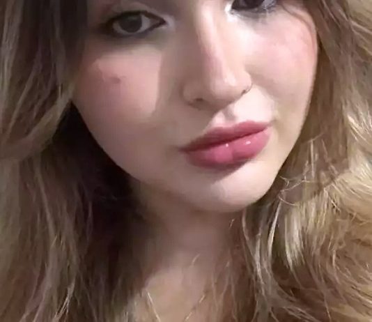 TRAGÉDIA: Jovem de 23 anos morre após queda de árvore na cabeça